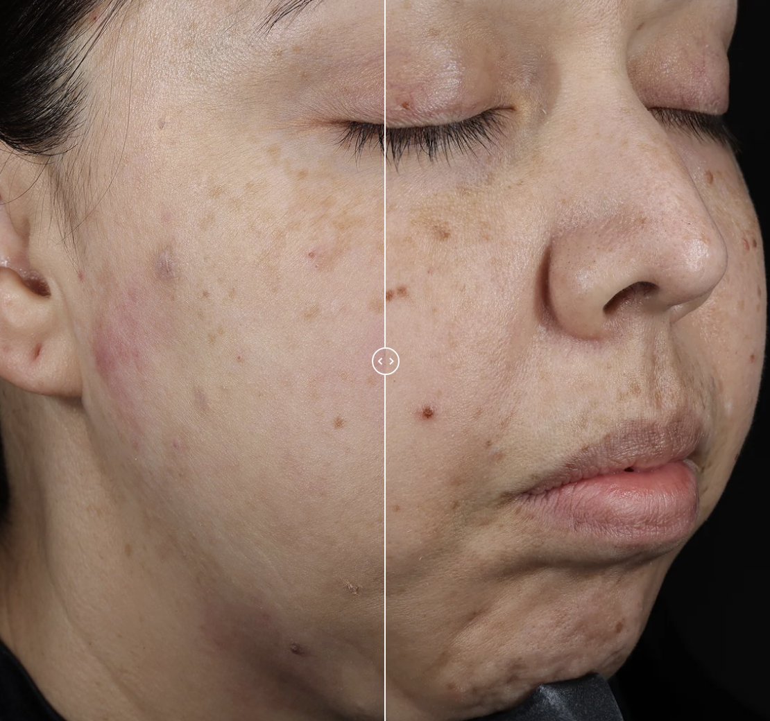 SUZANOBAGIMD MOISTURE RESTORE